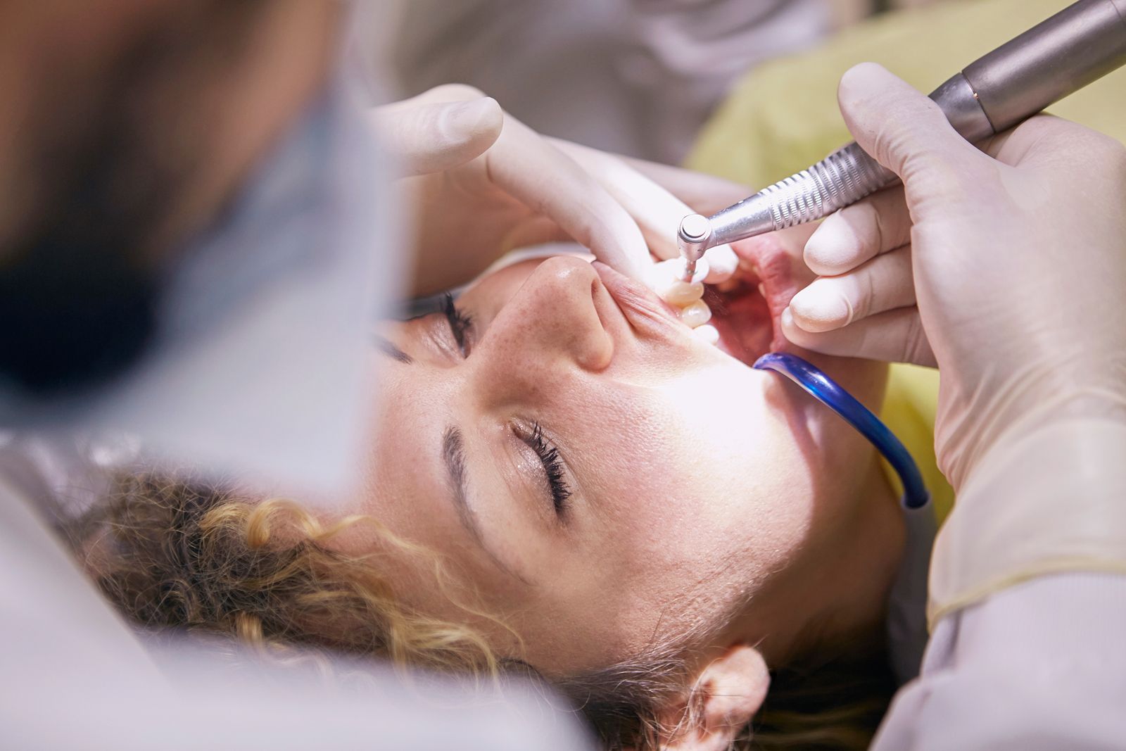 Close-up of a gentle professional dental cleaning
